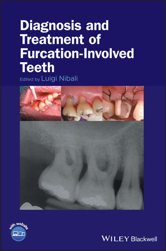 Группа авторов. Diagnosis and Treatment of Furcation-Involved Teeth