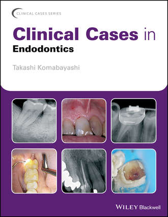 Группа авторов. Clinical Cases in Endodontics