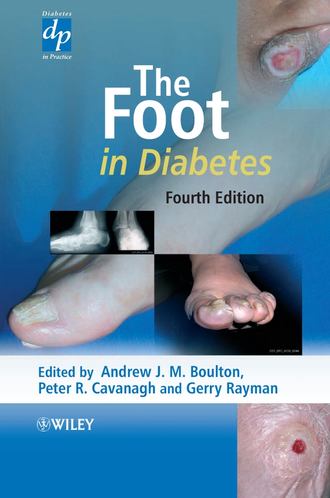 Gerry Rayman. The Foot in Diabetes