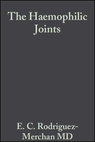 Группа авторов. The Haemophilic Joints