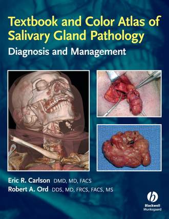 Robert  Ord. Textbook and Color Atlas of Salivary Gland Pathology