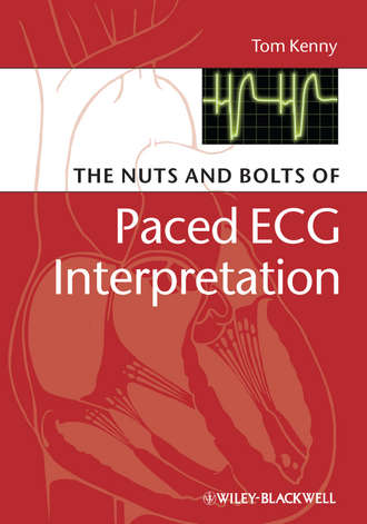 Группа авторов. The Nuts and bolts of Paced ECG Interpretation
