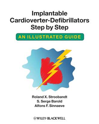 Roland Stroobandt X.. Implantable Cardioverter - Defibrillators Step by Step