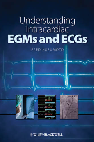 Группа авторов. Understanding Intracardiac EGMs and ECGs