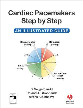 Roland Stroobandt X.. Cardiac Pacemakers Step-by-Step
