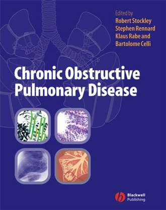 Klaus  Rabe. Chronic Obstructive Pulmonary Disease
