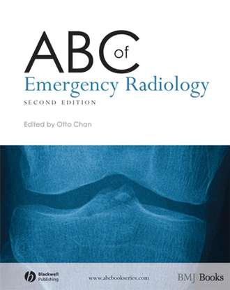 Группа авторов. ABC of Emergency Radiology