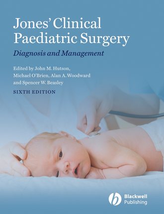 Michael  O'Brien. Jones' Clinical Paediatric Surgery