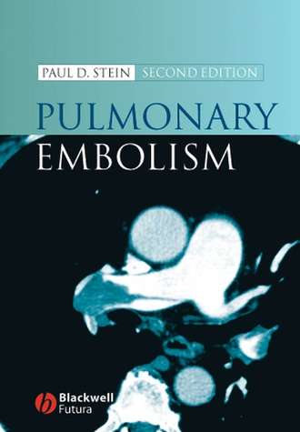 Группа авторов. Pulmonary Embolism
