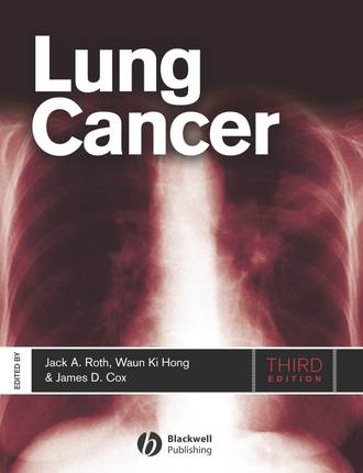 Jack Roth A.. Lung Cancer