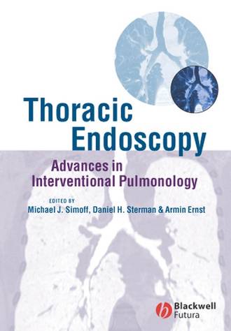 Thoracic Endoscopy. Armin  Ernst