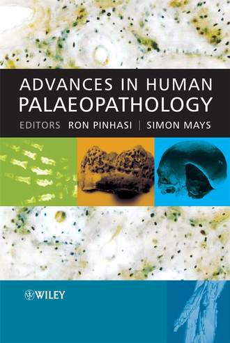 Simon  Mays. Advances in Human Palaeopathology