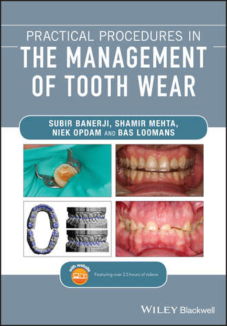 Practical Procedures in the Management of Tooth Wear. Shamir B. Mehta