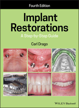 Carl Drago. Implant Restorations
