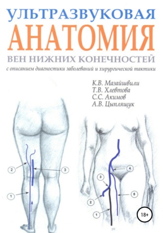 Ультразвуковая анатомия вен нижних конечностей. Константин Витальевич Мазайшвили
