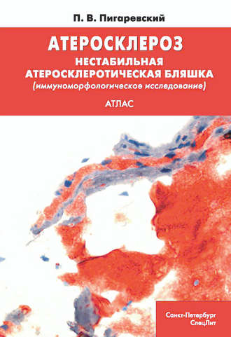 П. В. Пигаревский. Атеросклероз. Нестабильная атеросклеротическая бляшка (иммуноморфологическое исследование)