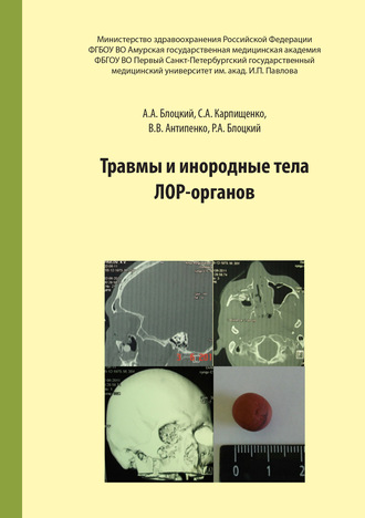 Травмы и инородные тела лор-органов. 