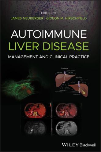 Группа авторов. Autoimmune Liver Disease