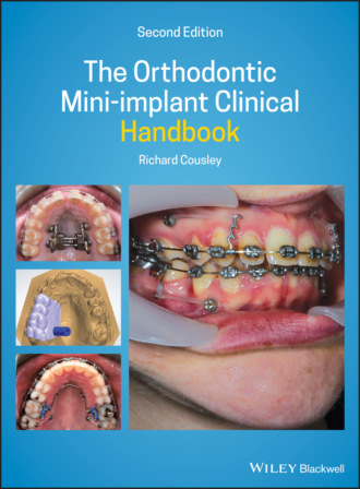 The Orthodontic Mini-implant Clinical Handbook. Richard Cousley