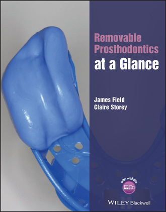 James Field. Removable Prosthodontics at a Glance