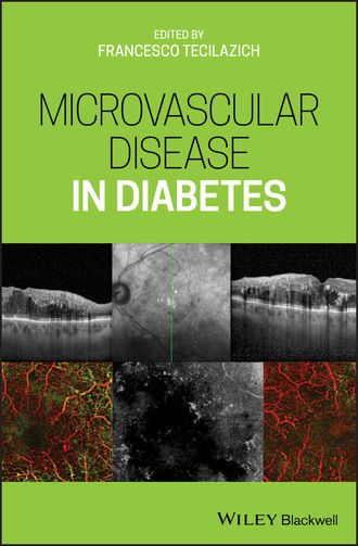 Группа авторов. Microvascular Disease in Diabetes