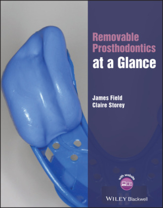 Removable Prosthodontics at a Glance. James Field