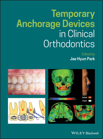 Группа авторов. Temporary Anchorage Devices in Clinical Orthodontics