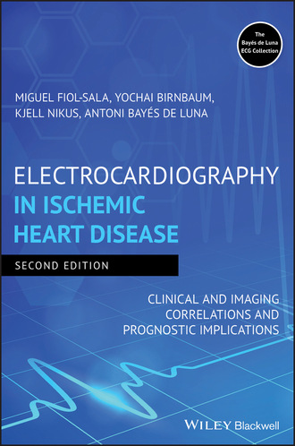 Miquel Fiol-Sala. Electrocardiography in Ischemic Heart Disease