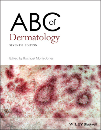 Группа авторов. ABC of Dermatology