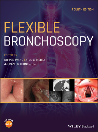 Группа авторов. Flexible Bronchoscopy