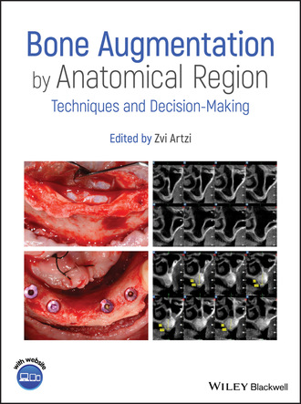 Группа авторов. Bone Augmentation by Anatomical Region