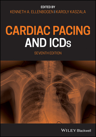 Группа авторов. Cardiac Pacing and ICDs