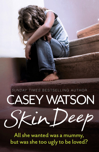 Casey Watson. Skin Deep