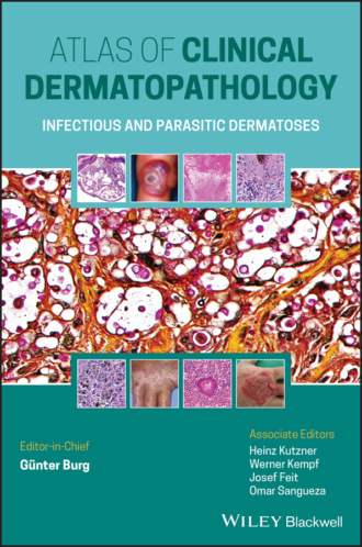 Atlas of Clinical Dermatopathology. Gunter Burg