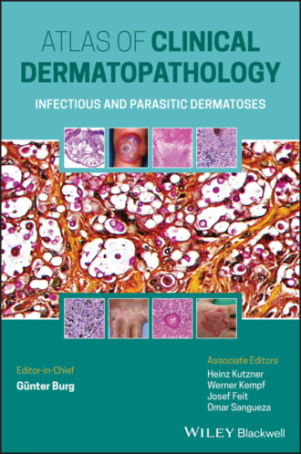 Gunter Burg. Atlas of Clinical Dermatopathology