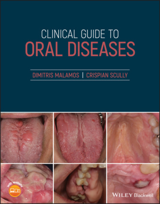 Clinical Guide to Oral Diseases. Crispian Scully
