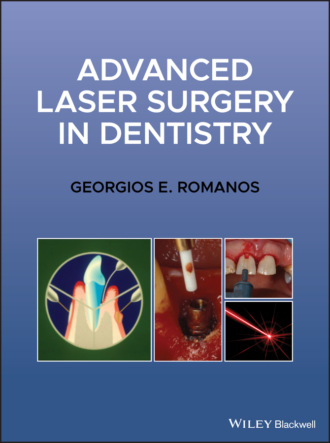 Georgios E. Romanos. Advanced Laser Surgery in Dentistry