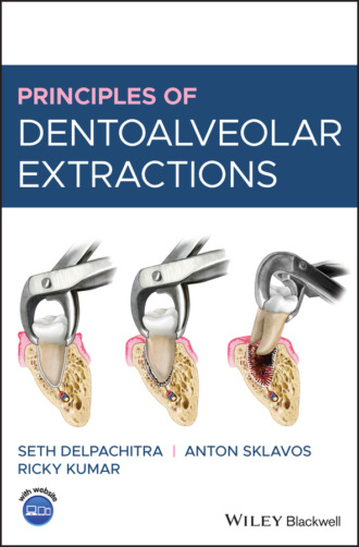 Seth Delpachitra. Principles of Dentoalveolar Extractions