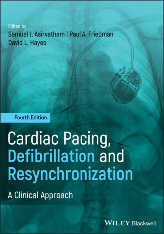 Группа авторов. Cardiac Pacing, Defibrillation and Resynchronization