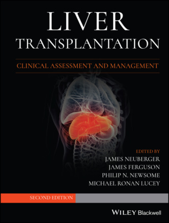 Группа авторов. Liver Transplantation