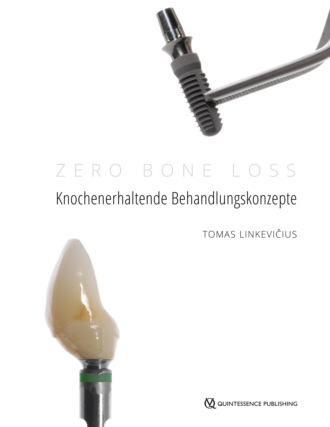 Tomas Linkevičius. Zero Bone Loss: Knochenerhaltende Behandlungskonzepte