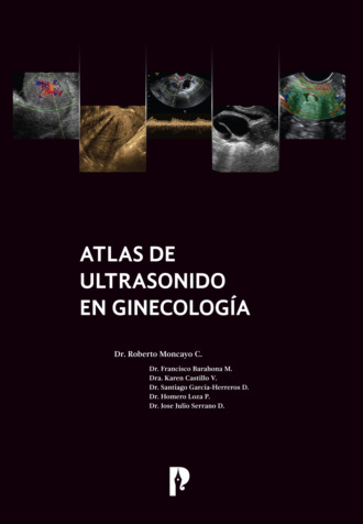 Roberto Moncayo. Atlas de ultrasonido en ginecolog?a