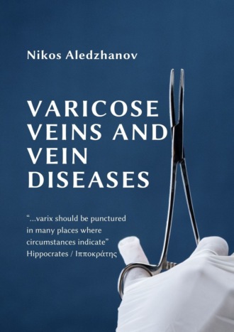 Nikos Aledzhanov. VARICOSE VEINS AND VEIN DISEASES