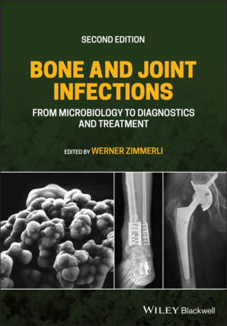 Bone and Joint Infections. Группа авторов