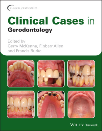 Группа авторов. Clinical Cases in Gerodontology