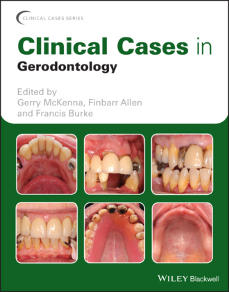 Clinical Cases in Gerodontology. Группа авторов