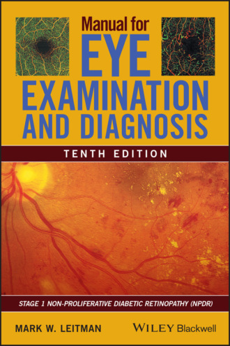 Mark W. Leitman. Manual for Eye Examination and Diagnosis