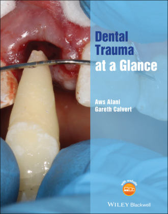 Aws Alani. Dental Trauma at a Glance