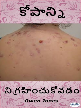 ముఖ మొటిమల చికిత్స. Оуэн Джонс