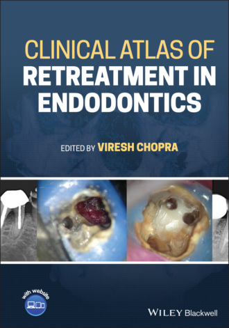 Группа авторов. Clinical Atlas of Retreatment in Endodontics